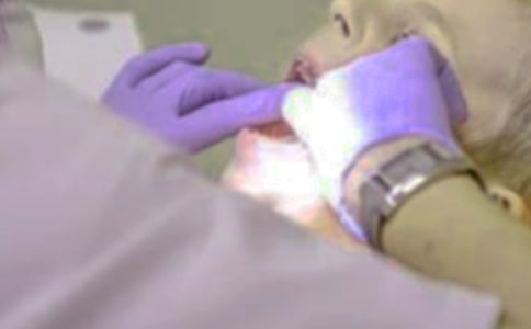 口腔執(zhí)業(yè)醫(yī)師考點(diǎn):拔牙刨面迅速止血法