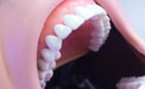 口腔執(zhí)業(yè)醫(yī)師考點:兒童常見牙齦炎