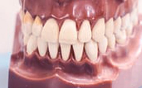 口腔執(zhí)業(yè)醫(yī)師考點(diǎn):牙齦表面解剖結(jié)構(gòu)