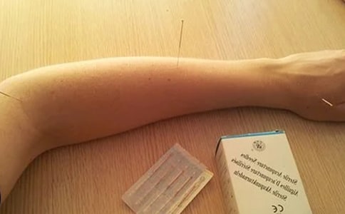 針灸之針刺手法