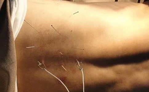 針灸推拿專業(yè)課程