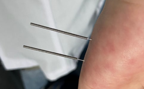 針灸科實(shí)習(xí)心得體會范文