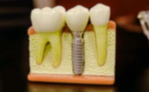 有關(guān)拔牙經(jīng)歷作文7篇